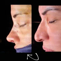 جراحی زیبایی اقساط|خدمات آرایشگری و زیبایی|تهران, امیریه|دیوار