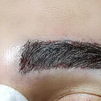 کاشت مو و کاشت ابرو، میکروگرافت|خدمات آرایشگری و زیبایی|کرمانشاه, |دیوار