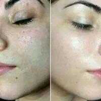 دنبال تناسب و لاغری  و زیبایی پوستتون
