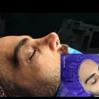 جراحی زیبایی بینی