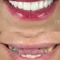 مرکز تخصصی دندانپزشکی ایمپلنت شرایط ویژه اقساطی|خدمات آرایشگری و زیبایی|تبریز, |دیوار