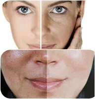 پاکسازی و فشیال پوست