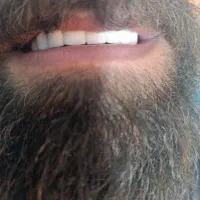 دندانپزشکی با تخفیف ٪40|خدمات آرایشگری و زیبایی|بروجرد, |دیوار