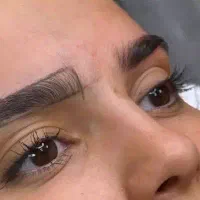 مدل برای فیبروز ابرو