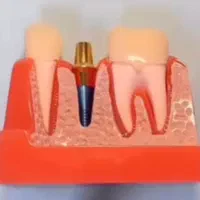 خدمات دندانپزشکی اقساط و چک