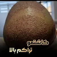 کاشت تخصصی مو وابرو|خدمات آرایشگری و زیبایی|یاسوج, |دیوار