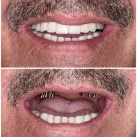 جشنواره مرکز تخصصی دندانپزشکی با شرایط پرداخت ویژه
