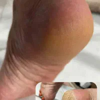 اموزش خصوصی و تخصصی پدیکور و کفسابی