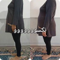 لاغری و درمان کبد چرب بدون دارو در مشهد
