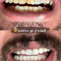 کامپوزیت لبه شیشه ای فکی ۱۸،۵۵۰