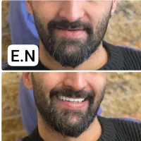 دندان سازی