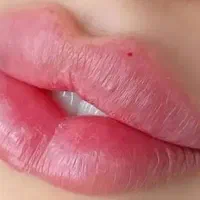 خدمات با تخفیف ژل و بوتاکس مزوژل در کلینیک پزشک|خدمات آرایشگری و زیبایی|اصفهان, وحید|دیوار