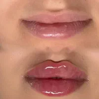 آموزش فیلر چونه بوتاکس ژل لب مزوژل پرسینگ|خدمات آرایشگری و زیبایی|مشهد, موسوی قوچانی|دیوار