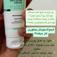 پک ضد جوش|آرایشی، بهداشتی، درمانی|تهران, دروس|دیوار