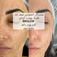 فیشیال مزوتراپی(کرم پودردائم)مرکززیبای تعرفه دولتی|آرایشی، بهداشتی، درمانی|نجفآباد, بازار|دیوار