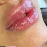 لیزر(خانم ها)۳۰۰لیزر(آقایان )۶۰۰کربن تراپی رایگان|خدمات آرایشگری و زیبایی|نجف‌آباد, باغ ملی|دیوار