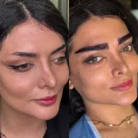کاشت ابرو با تعرفه ویژه فقط ۱۴۹۰۰