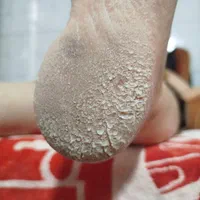 شروع دوره پدیکور