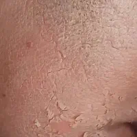 پاکسازی صورت مطب دکتر آذین اسکندری|خدمات آرایشگری و زیبایی|دوگنبدان, |دیوار