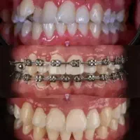 دندانپزشکی مرکز تخصصی ارتودنسی باشرایط فوق العاده|خدمات زیبایی و سلامت|شیراز, عفیفآباد|دیوار