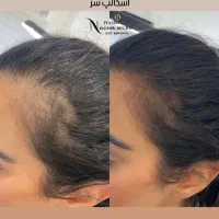 فیبروز ابرو شیدینگ لب و اسکالپ سر بانوان و اقایان|خدمات آرایشگری و زیبایی|صدرا-فارس, فاز ۱|دیوار