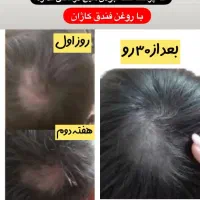 روغن های کاژان|آرایشی، بهداشتی، درمانی|بهبهان, |دیوار