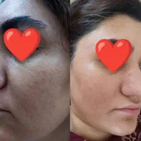 مراقبت پوست و مو|آرایشی، بهداشتی، درمانی|اصفهان, آبشار|دیوار
