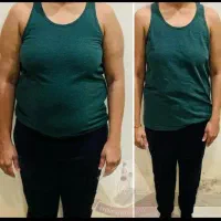 دستگاه لاغری، اسپارتینا،کاهش وزن سایز، زریق آمپول