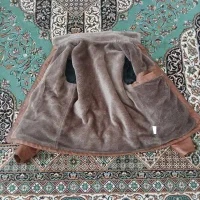 کاوشن چشمم نوعه