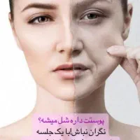 هایفوتراپی،رفع غبغب،لیزر،امبدینگ لاغری،prp