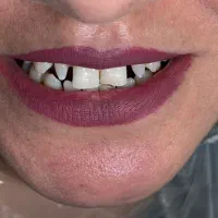 اصلاح لبخند بدون آسیب مشاوره رایگان|خدمات آرایشگری و زیبایی|شیراز, نشاط|دیوار