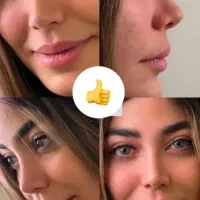 جشنواره تابستانه عمل جراحی بینی بدون تامپون/لیفت|خدمات زیبایی و سلامت|کرج, اصفهانیها|دیوار