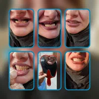 خدمات تخصصی پروتز متحرک(دندان مصنوعی)|خدمات آرایشگری و زیبایی|قزوین, |دیوار