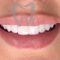 آفر ویژه برای خدمات درمانی و زیبایی دندانپزشکی