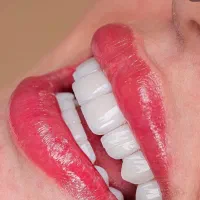 تخفیف ویژه کامپوزیت زیبایی دندان «یاسوج»