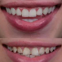 بالاترین کیفیت وارزانترین قیمت خدمات دندانپزشکی|خدمات آرایشگری و زیبایی|شیراز, سینما سعدی|دیوار