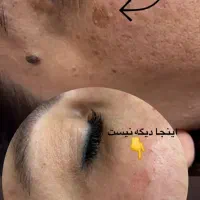 ریمولک تک جلسه ایی|خدمات آرایشگری و زیبایی|سرپل ذهاب, |دیوار