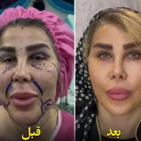 جشنواره تخفیف جراحی زیبایی شقیقه،بلفارو،دایرکت|خدمات آرایشگری و زیبایی|پرند, فاز ۲|دیوار