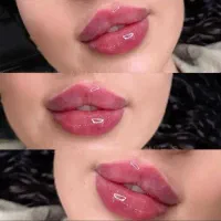 جراحی پلک غبغب صورت نخ آنزیم فیلر مزو ژل بوتاکس|خدمات آرایشگری و زیبایی|کرج, گوهردشت|دیوار