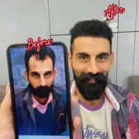 کاشت مو|خدمات آرایشگری و زیبایی|کرمانشاه, |دیوار