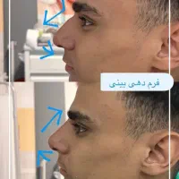 بینی|آرایشی، بهداشتی، درمانی|تهران, آسمان|دیوار