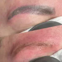 پاک کردن تاتو ابرو وبدن،کربن تراپی