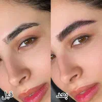 مرکز تخصصی میکروبلیدینگ ابرو (تخفیف استثنایی)