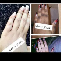 فرمول روشن کننده صورت ودستوپا عربی