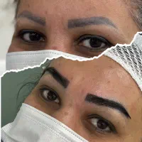 نیازمند مدل با چهره زیبا کاشت ابرو