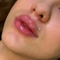 نیازمند مدل خانوم بوتاکس و فیلر و ... بدون پرداختی|خدمات آرایشگری و زیبایی|ساری, |دیوار