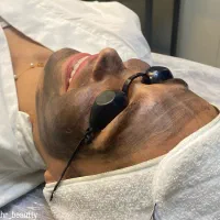 تخفیف ویژه پاکسازی صورت ویژه آقایان و خانم ها