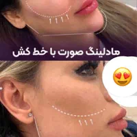 کلینیک مادلینگ 3900تزریق ژللب بیکینی390بوتاکس لیزر|خدمات آرایشگری و زیبایی|تهران, ستارخان|دیوار