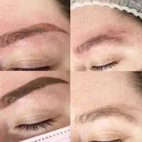 اموزش تخصصی ریموو