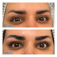 خدمات تخصصی لیفت